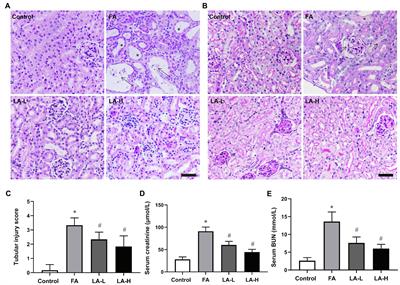 A-Lipoic Acid Alleviates Folic Acid-Induced Renal Damage Through Inhibition of Ferroptosis